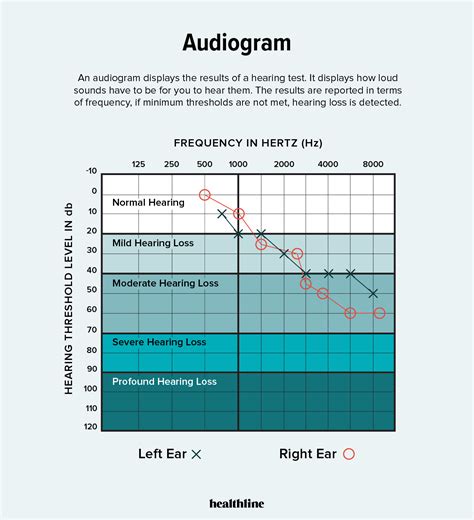 interpreting tympanogram|Interpreting the tests – Audiogram and Tympanogram .